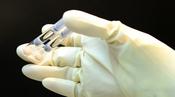 Pre-filled syringes of  the adalimumab biosimilar.  The biosimilar is used in the treatment of rheumatoid arthritis, juvenile idiopathic arthritis, psoriatic arthritis and ankylosing spondylitis.