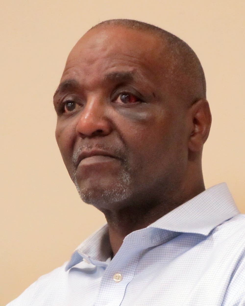 Al Flowers Files Excessive Force Complaint Against Minneapolis Police Mpr News