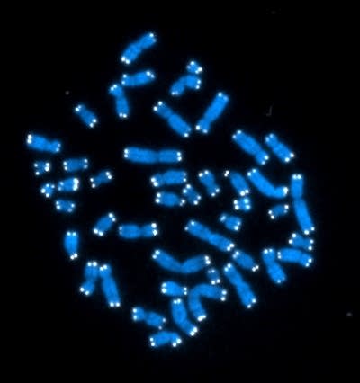 Human chromosomes