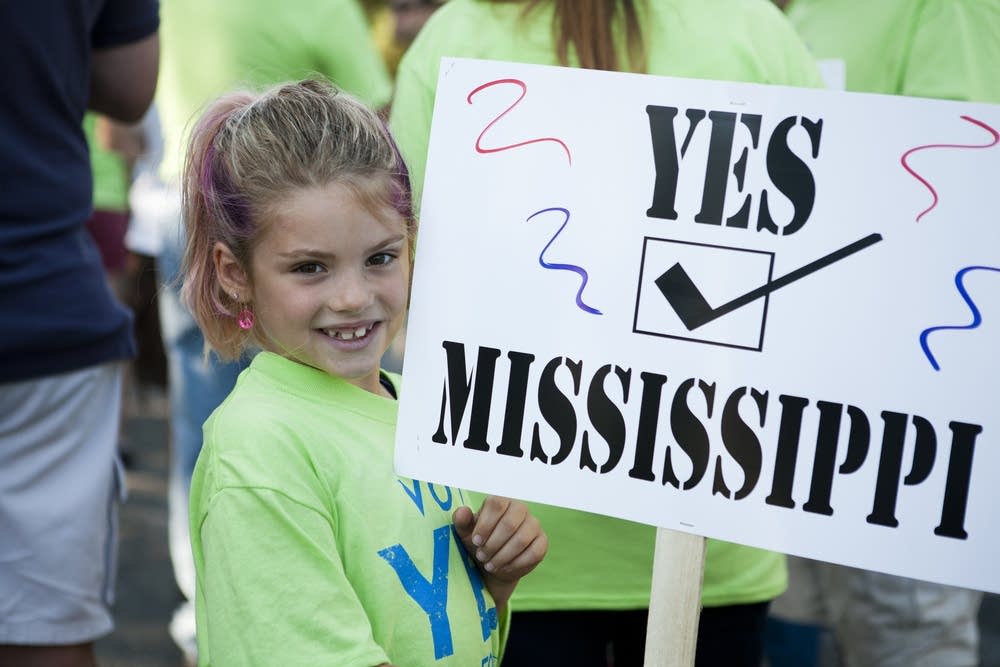 Yes Mississippi!