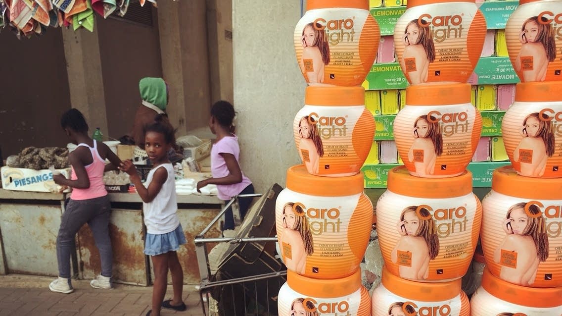 Skin-bleaching beauty products for sale in a South African community.