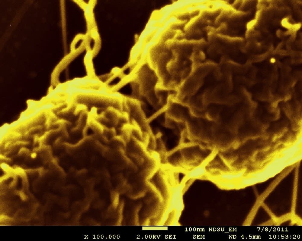 E. coli biofilm