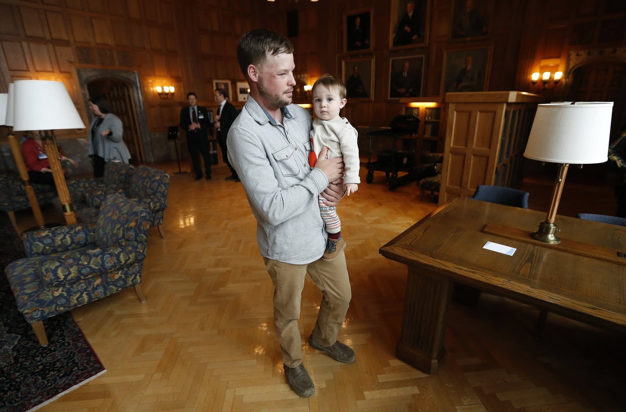 Face transplant recipient Andy Sandness holds 17-month-old Leonard Ross.