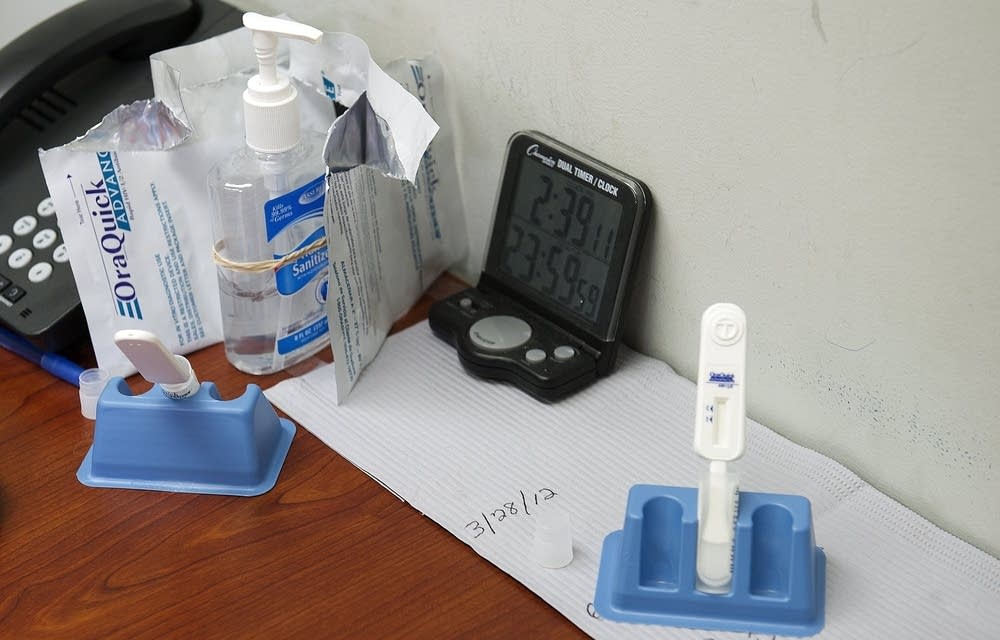 HIV test