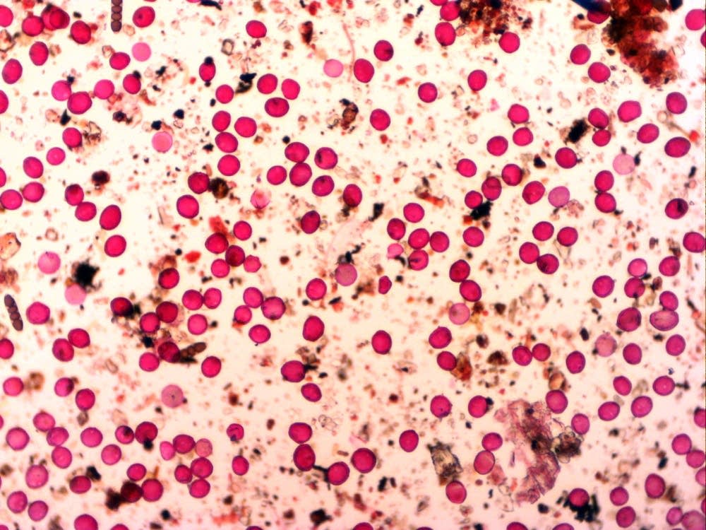 A sample of mixed tree pollens