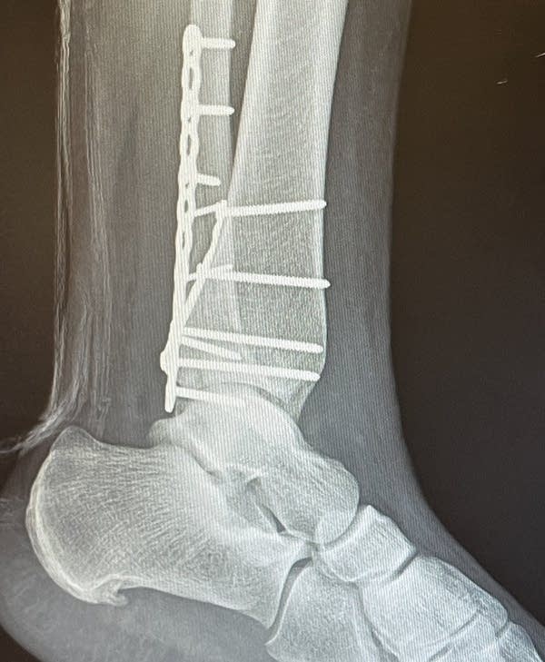 Coffee Break: Bone songs