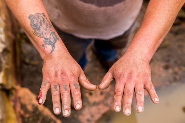 Travis Erickson's hands