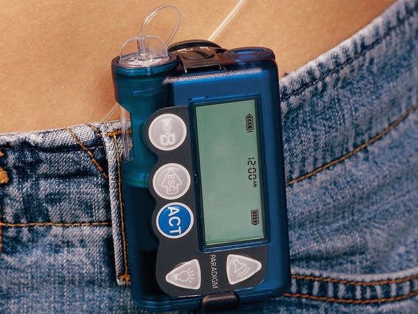 Medtronic insulin pump