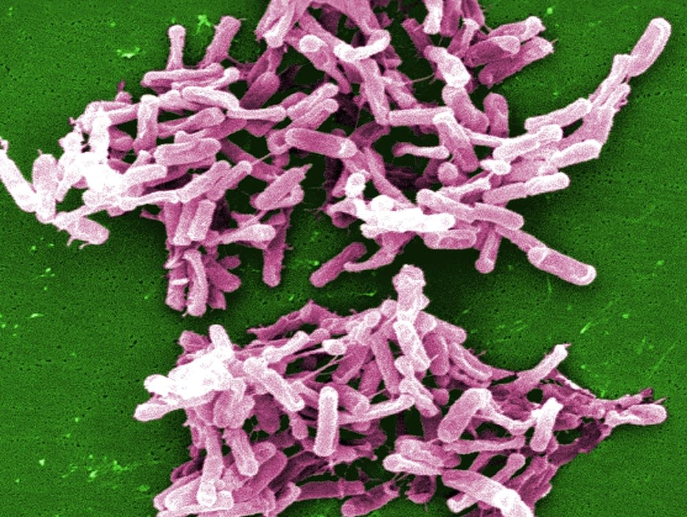 入手困難！BACTERIA 　LOST　CD Minnesota faces challenge in halting deadly colon infection's
