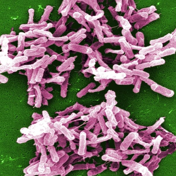 52bc5d-20150609-cdiff.jpg