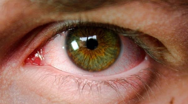 Networks are fighting for your binging, bloodshot eyeballs