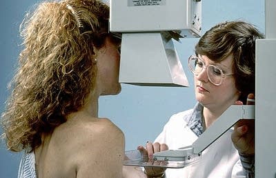 Mammogram