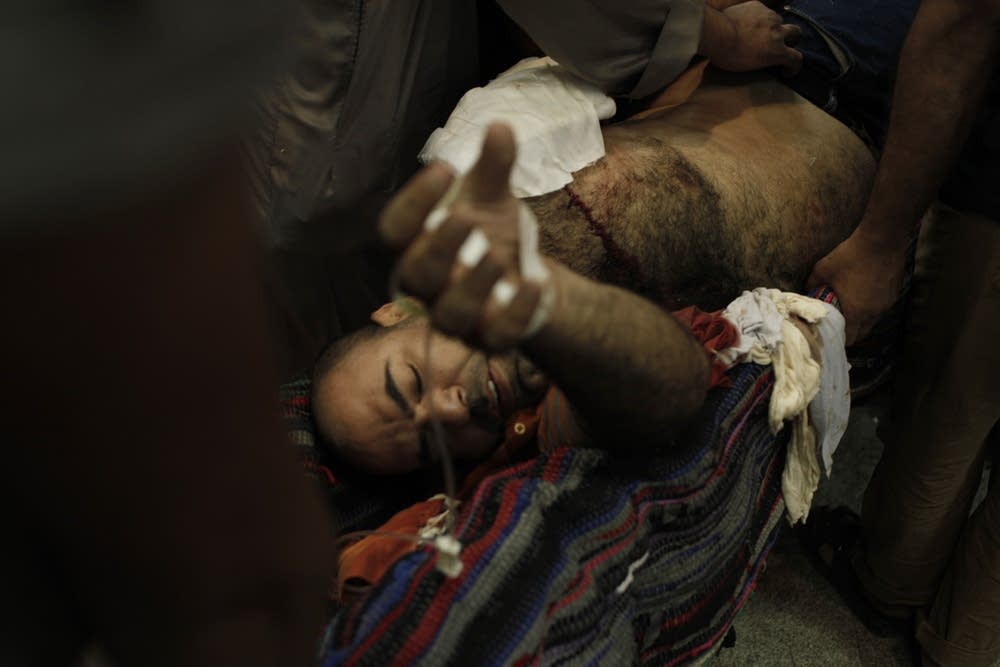 Morsi supporter on stretcher