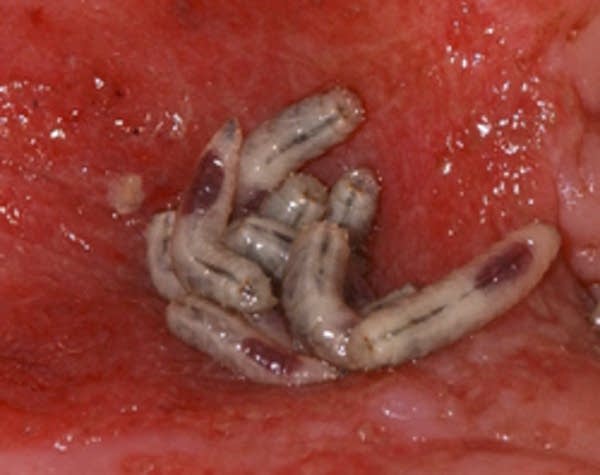 Medical maggots