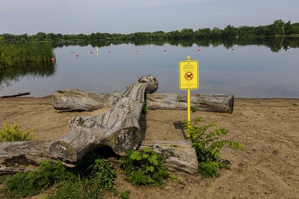 Minnesota beaches are closed due to bacteria, toxic algae. Here's where and what to look for. 