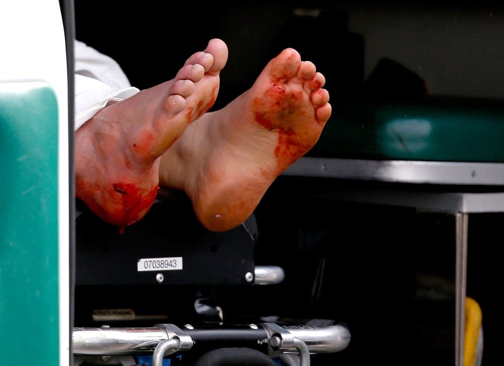 Blood on feet