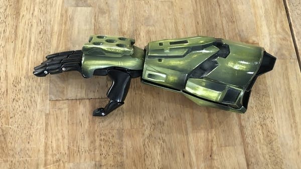 3D printing was supposed to disrupt prosthetic costs. It hasn’t.