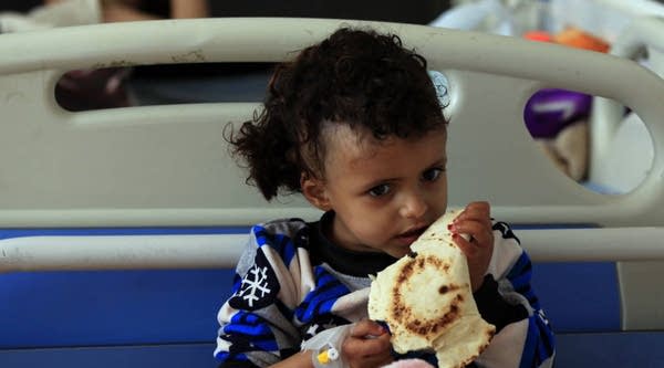 A Yemeni child suffering from a diphtheria infection nibbles a piece of bread on a hospital bed in the capital Sana'a in October.