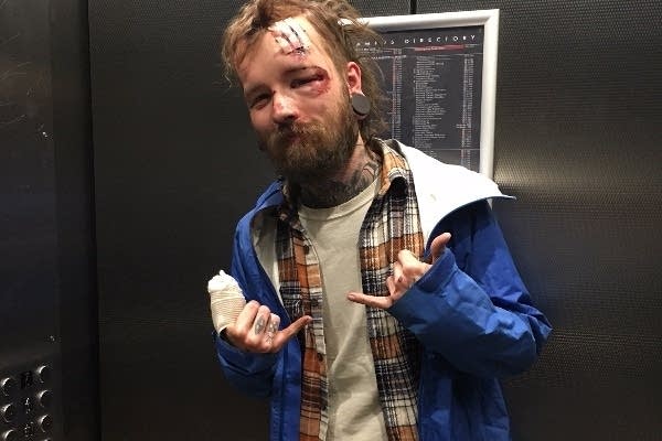 Driver who hit cyclist in Minneapolis couldn’t be bothered to stop